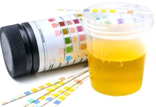 Μικροβιολογικό Καρακάση Μοίρες Ηρακλείου Μικροβιολόγος